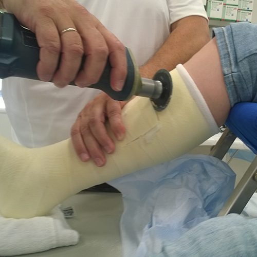 Изображение ПРАКТИЧЕСКИЕ СОВЕТЫ ПО НАЛОЖЕНИЮ ИММОБИЛИЗИРУЮЩИХ ПОВЯЗОК