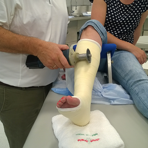 Изображение ПРАКТИЧЕСКИЕ СОВЕТЫ ПО НАЛОЖЕНИЮ ИММОБИЛИЗИРУЮЩИХ ПОВЯЗОК