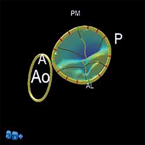 Изображение УЛЬТРАЗВУКОВОЙ АППАРАТ CX50