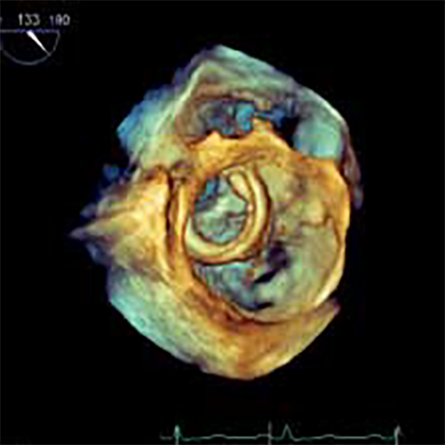 Изображение УЛЬТРАЗВУКОВОЙ АППАРАТ CX50