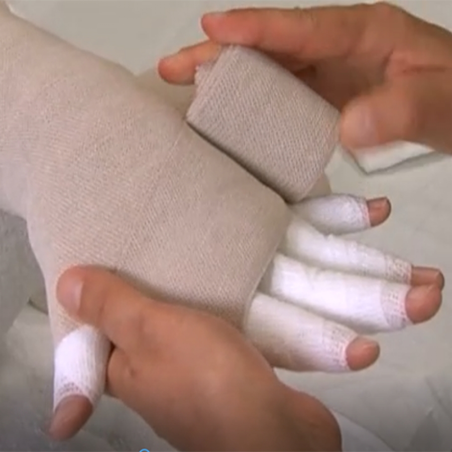 Изображение ВИДЕОКУРС №2 БИНТОВАНИЕ РУКИ