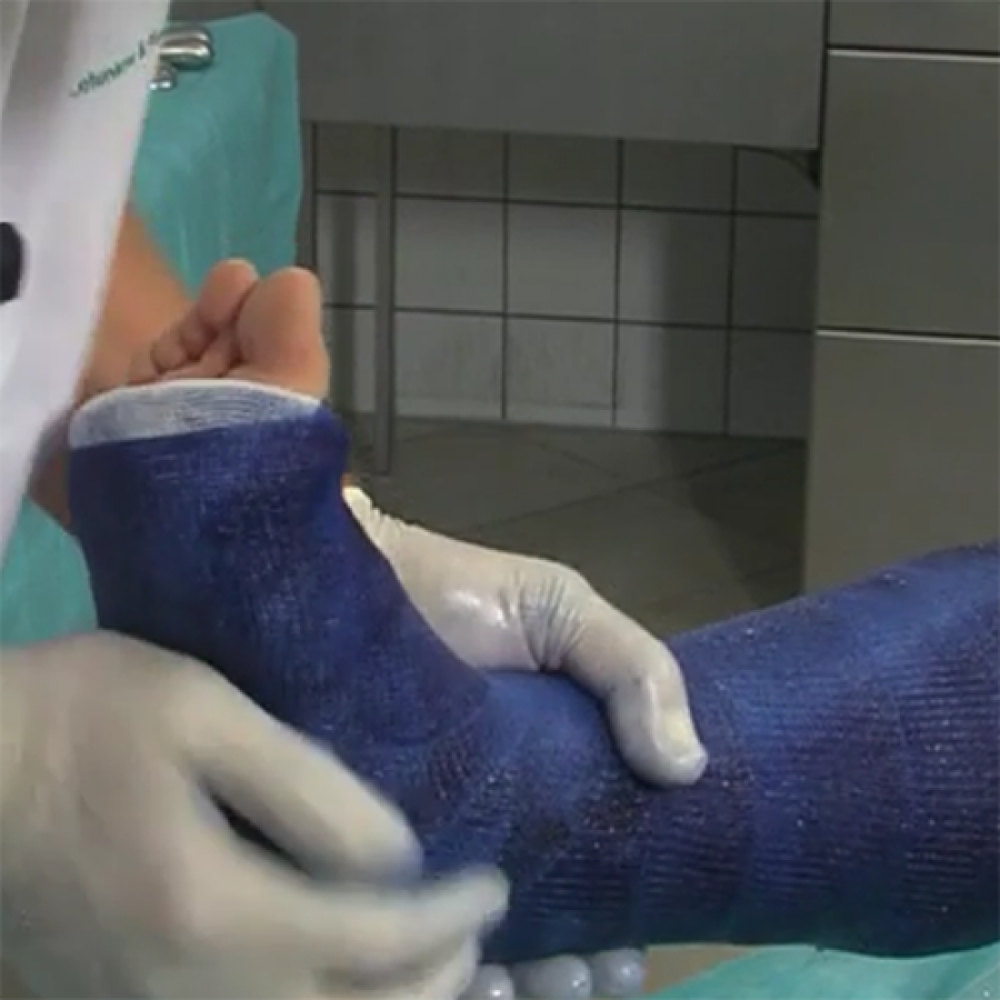 Изображение ПОВЯЗКА ИЗ ЦЕЛЛАКAСТА НА ГОЛЕНЬ