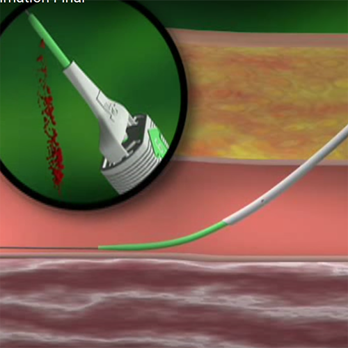 Изображение АНГИОСИЛ УСТРОЙСТВО ДЛЯ ЗАКРЫТИЯ ПУНКЦИИ (ANGIO-SEAL VIP)
