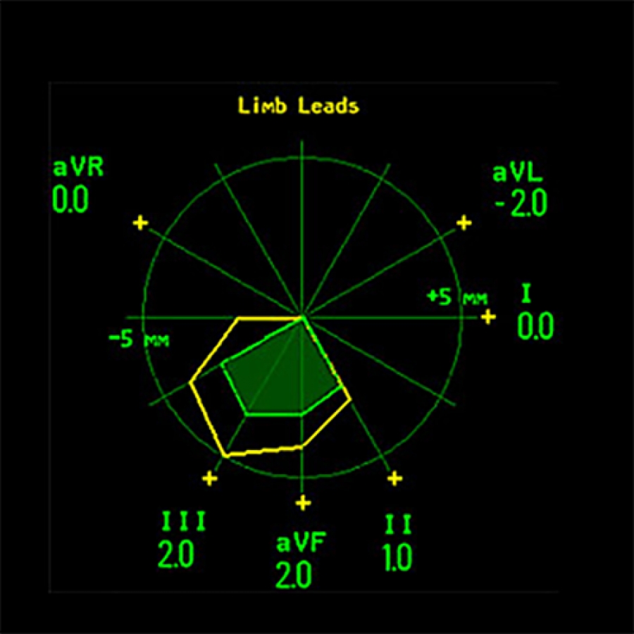 Изображение КАРТА СЕГМЕНТА ST