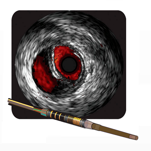 Изображение ЦИФРОВЫЕ КАТЕТЕРЫ ДЛЯ ПЕРИФЕРИЧЕСКИХ ВНУТРИСОСУДИСТЫХ УЛЬТРАЗВУКОВЫХ ИССЛЕДОВАНИЙ VISIONS