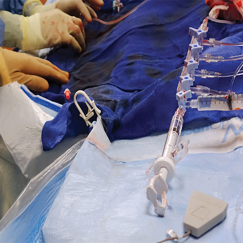 Изображение ПРОВОДНИКИ С ДАТЧИКОМ ДАВЛЕНИЯ ДЛЯ ИЗМЕРЕНИЯ ФРАКЦИОННОГО РЕЗЕРВА VERRATA PLUS