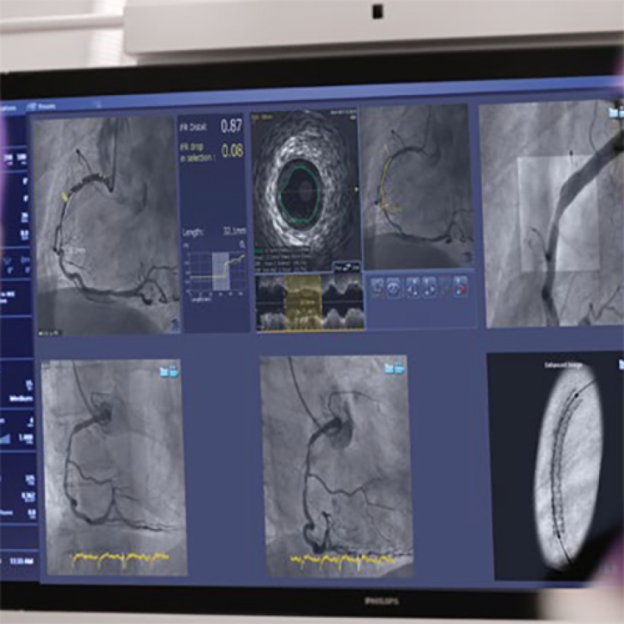 Изображение СИСТЕМА СИНХРОНИЗАЦИИ ИЗОБРАЖЕНИЯ SYNCVISION
