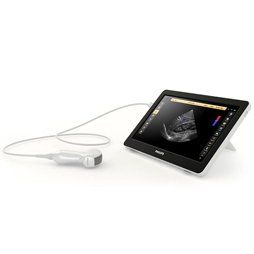 Изображение ПОРТАТИВНЫЙ УЗИ АППАРАТ INNOSIGHT