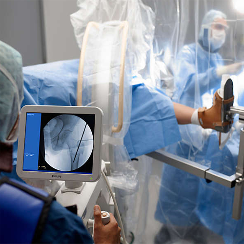 Изображение BV PULSERA ПЕРЕДВИЖНОЙ РЕНТГЕНХИРУРГИЧЕСКИЙ АППАРАТ