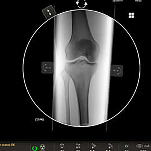 Изображение VERADIUS UNITY ПЕРЕДВИЖНОЙ РЕНТГЕНХИРУРГИЧЕСКИЙ АППАРАТ С ПЛОСКИМ ДЕТЕКТОРОМ