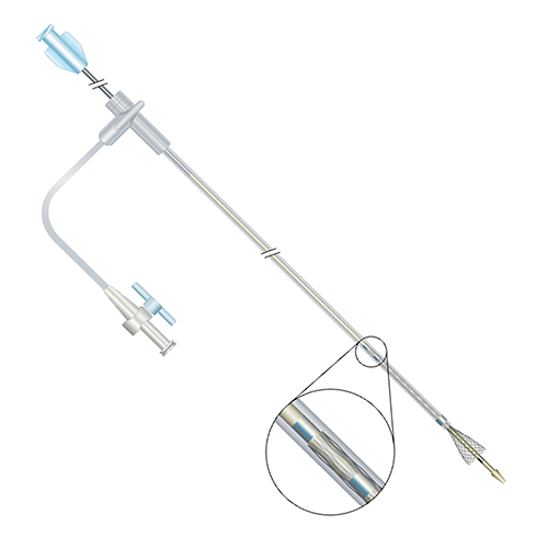 Изображение САМОРАСШИРЯЮЩИЙСЯ СТЕНТ WALLSTENT-UNI