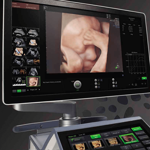 Изображение ЗНАМЕНИТЫЙ УЗИ АППАРАТ VOLUSON E8 (ЖЕНСКОЕ ЗДОРОВЬЕ)