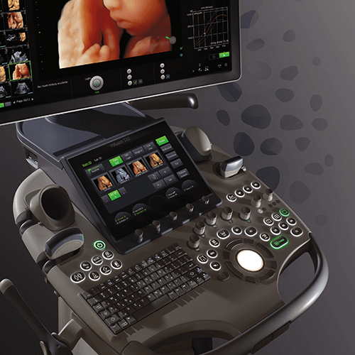 Изображение УЗИ АППАРАТ VOLUSON S10 (УНИВЕРСАЛЬНАЯ СИСТЕМА ДЛЯ ЧАСТНОЙ КЛИНИКИ)