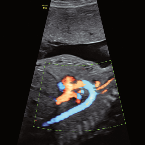 Изображение УЗИ АППАРАТ VOLUSON S10 (УНИВЕРСАЛЬНАЯ СИСТЕМА ДЛЯ ЧАСТНОЙ КЛИНИКИ)