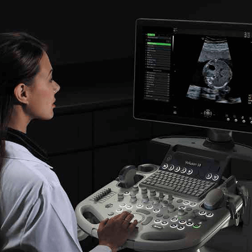 Изображение УЗИ АППАРАТ VOLUSON S8 (ВЫСОКИЙ ПОТОК ПАЦИЕНТОВ)