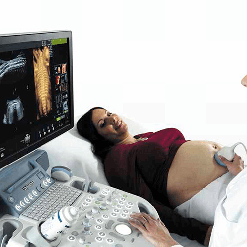 Изображение УЗИ АППАРАТ VOLUSON S8 (ВЫСОКИЙ ПОТОК ПАЦИЕНТОВ)