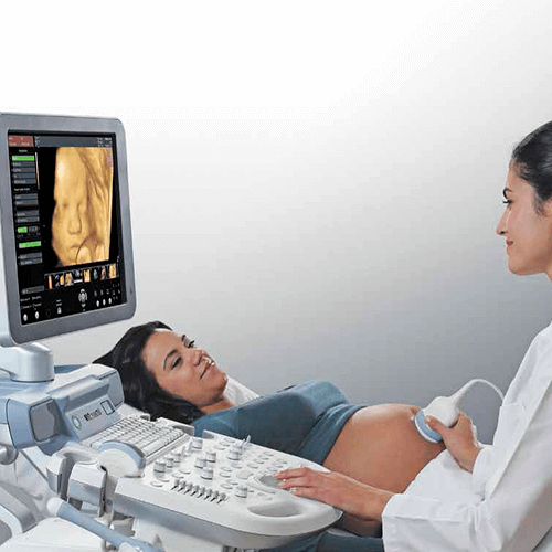 Изображение УЗИ АППАРАТ VOLUSON P8 (ДЛЯ НЕБОЛЬШИХ КАБИНЕТОВ)