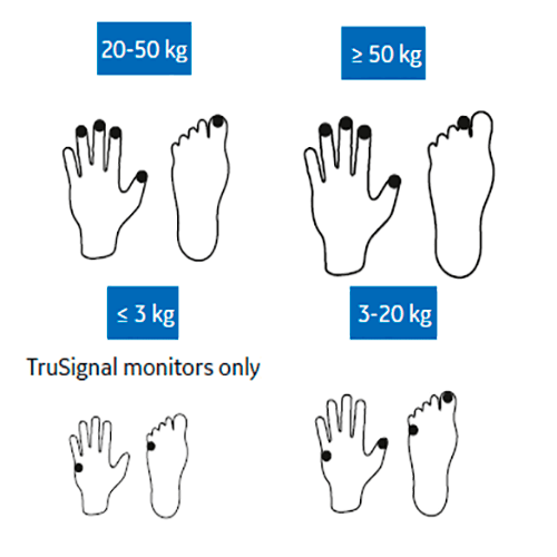 Изображение МНОГОРАЗОВЫЙ ДАТЧИК ПУЛЬСОКСИМЕТРИЧЕСКИЙ ВЗРОСЛЫЙ/ДЕТСКИЙ/НЕОНАТАЛЬНЫЙ TS-SE-3
