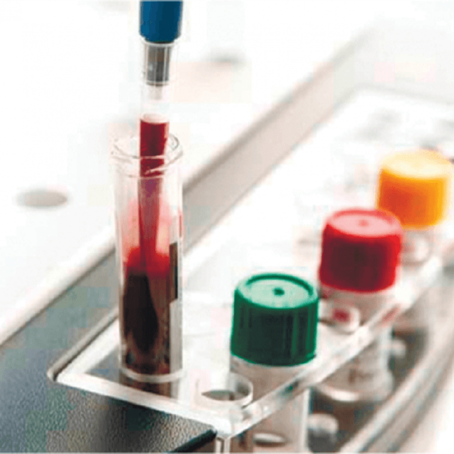 Изображение КОНТРОЛЬНЫЙ МАТЕРИАЛ ДЛЯ АНАЛИЗАТОРА ФУНКЦИИ ТРОМБОЦИТОВ MULTIPLATE ANALYZER (LIQUID CONTROL SET)