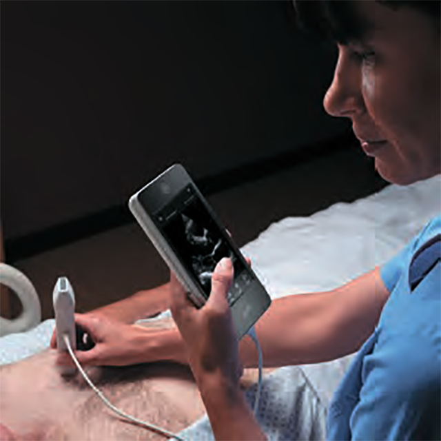 Изображение ПЕРЕНОСНОЙ УЗИ АППАРАТ VSCAN EXTEND (КАРМАННЫЙ)