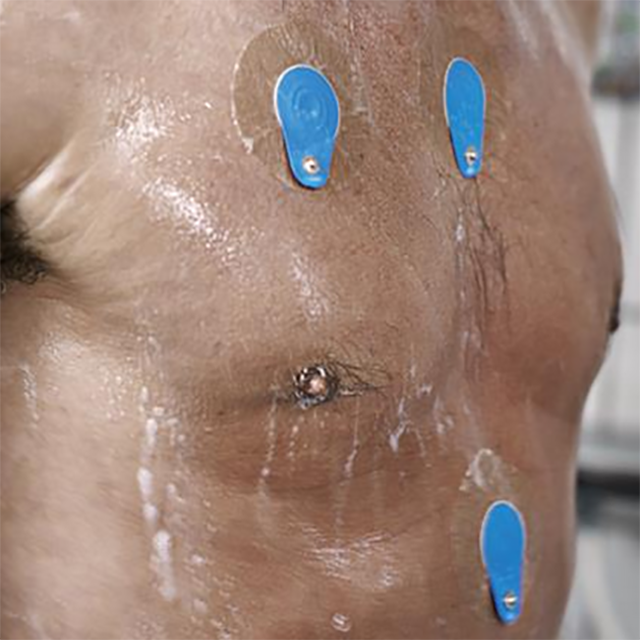 Изображение ЭКГ ЭЛЕКТРОД ДЛЯ ДЛИТЕЛЬНОГО МОНИТОРИРОВАНИЯ ДЛЯ ЧУВСТВИТЕЛЬНОЙ КОЖИ BLUESENSOR VLC