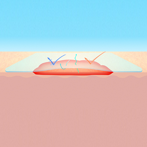 Изображение СУПРАСОРБ F (SUPRASORB F) ПЛЕНКА ЗАЩИТНАЯ