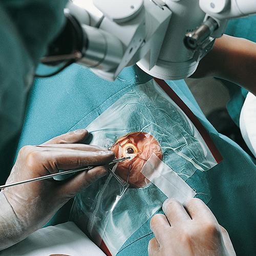 Изображение СИСТЕМА ДЛЯ ДРЕНИРОВАНИЯ СЛЕЗЫ ПРО-ОФТА