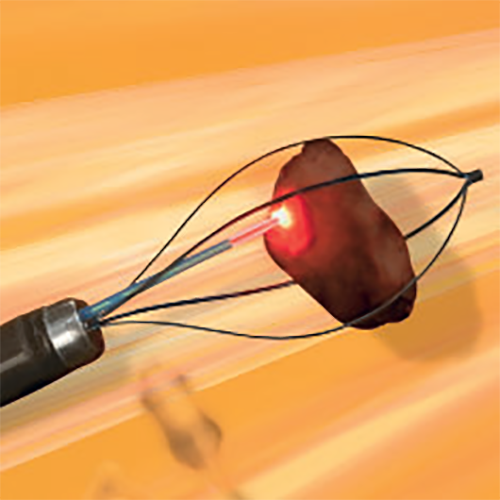 Изображение НИТИНОЛОВАЯ КОРЗИНА ДЛЯ ЛИТОЭКСТРАКЦИИ И ЛИТОТРИПСИИ ESCAPE