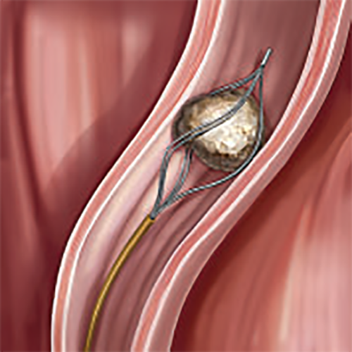 Изображение СПИРАЛЕВИДНЫЕ КОРЗИНЫ С ПАРНЫМИ СТРУНАМИ GEMINI