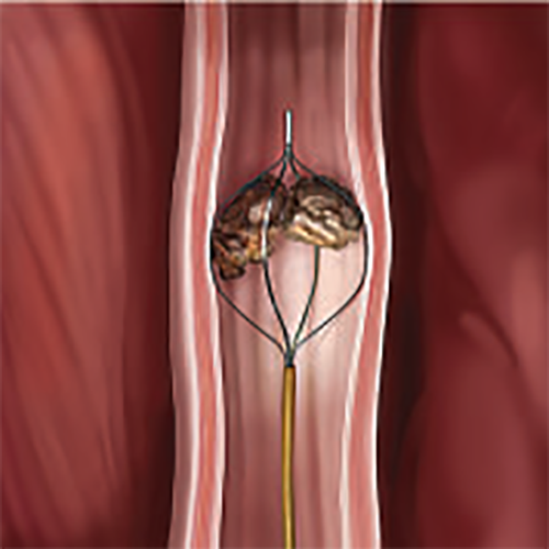 Изображение КОРЗИНЫ С ПЛОСКИМИ СТРУНАМИ SEGURA