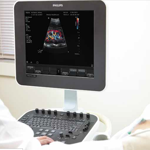 Изображение УЛЬТРАЗВУКОВОЙ АППАРАТ CLEARVUE 350