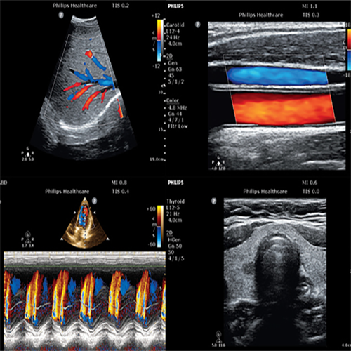 Изображение УЛЬТРАЗВУКОВОЙ АППАРАТ CLEARVUE 850