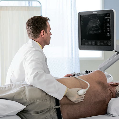 Изображение УЛЬТРАЗВУКОВОЙ АППАРАТ CLEARVUE 850