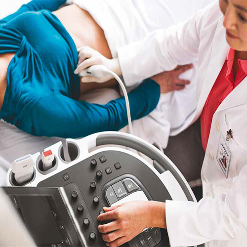 Изображение УЛЬТРАЗВУКОВОЙ АППАРАТ AFFINITY 70