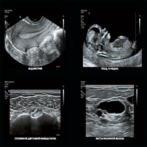 Изображение УЛЬТРАЗВУКОВОЙ АППАРАТ EPIQ ELITE