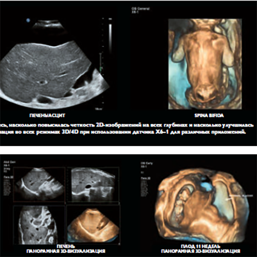 Изображение УЛЬТРАЗВУКОВОЙ АППАРАТ EPIQ ELITE