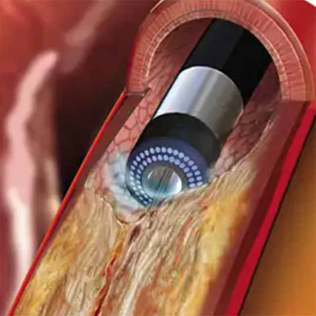 Изображение ЭКСИМЕРНАЯ ЛАЗЕРНАЯ СИСТЕМА CVX-300 EXCIMER