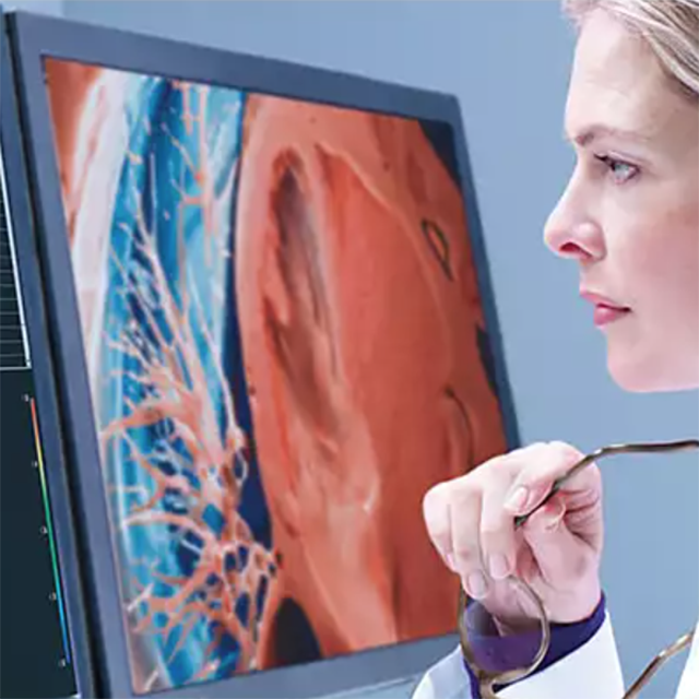 Изображение PHILIPS INTELLISPACE PORTAL 12