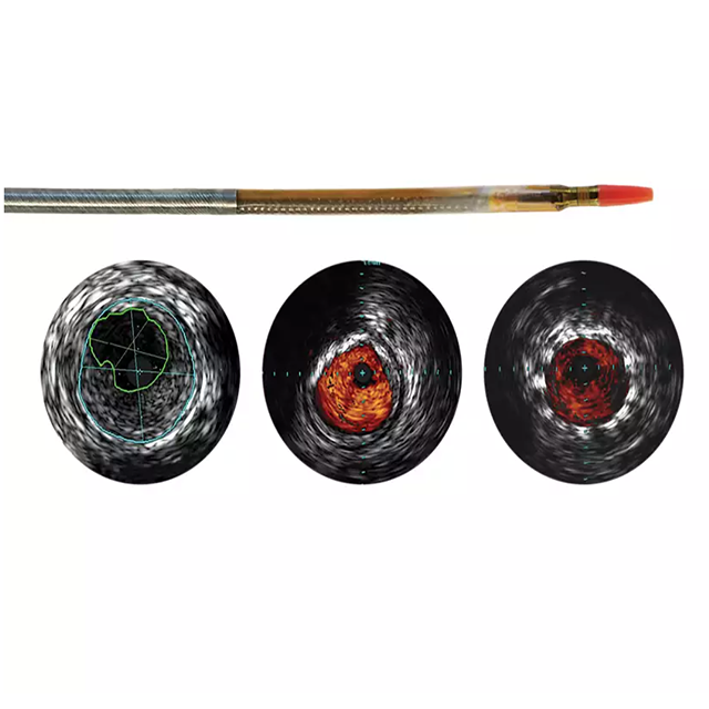 Изображение ЦИФРОВОЙ КАТЕТЕР ДЛЯ ВСУЗИ RECONNAISSANCE